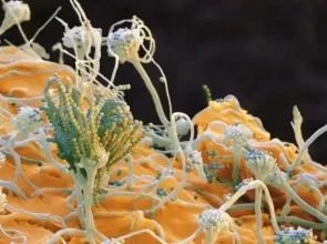 Pelējums dzīvoklī, vairāk nekā nepatīkams skats uz sienām